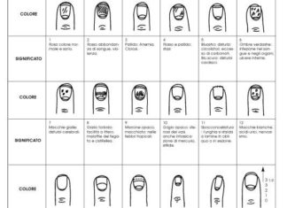 Unghie striate o rigate: le cause e i rimedi