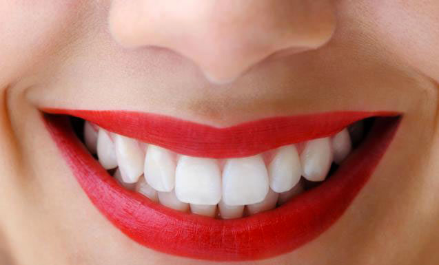 Come avere denti bianchissimi: i rimedi naturali