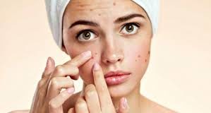 Combattere i brufoli: i consigli per prevenirne la comparsa