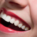 denti-bianchi