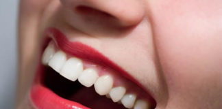 SOS denti bianchi: come avere un sorriso perfetto