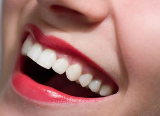 SOS denti bianchi: come avere un sorriso perfetto