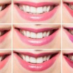 rossetto_1
