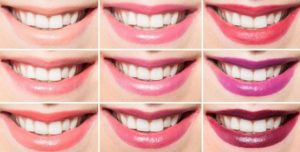 rossetto_1